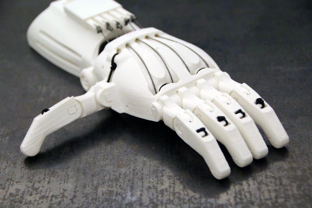 3D Printed Prosthetic