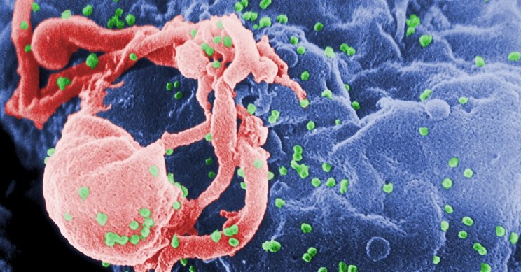 HIV 
(human immunodeficiency virus)