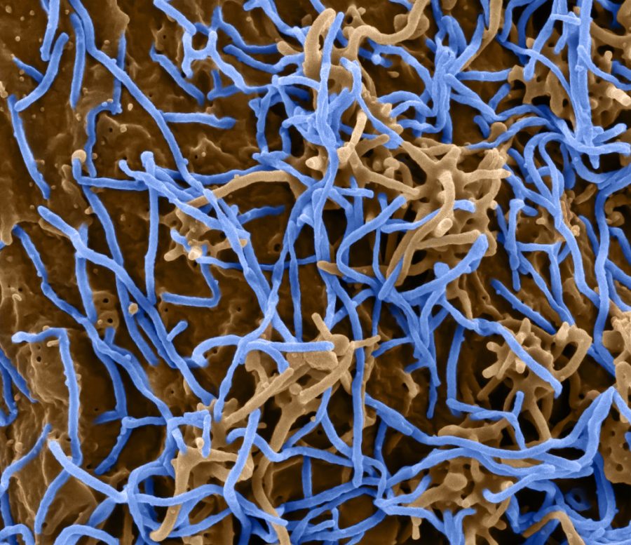 Ebola+Virus+Particles+by+NIAID+is+licensed+under+CC+BY+2.0
