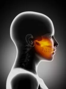 Trigeminal Neuralgia